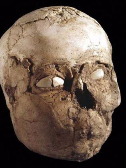 <p>Şanlıurfa’daki 12 bin yıllık sit alanı Göbeklitepe’de kazı çalışmaları sırasında parçalanmış halde binlerce insan kemiğine ulaşıldı. Bunların arasında, üzerinde izler ve delikler bulunan kafatası parçaları da bulunuyor.</p>

<p> </p>
