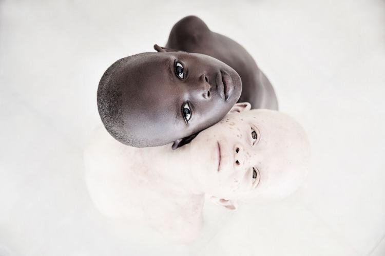 <p>Fotoğrafçılık ile ilgilenen Hollandalı bir sanatçının Tanzanya'da albinizmli çocuklar ile yaptığı özel çalışma, sosyal medyada ilgi gördü.</p>
