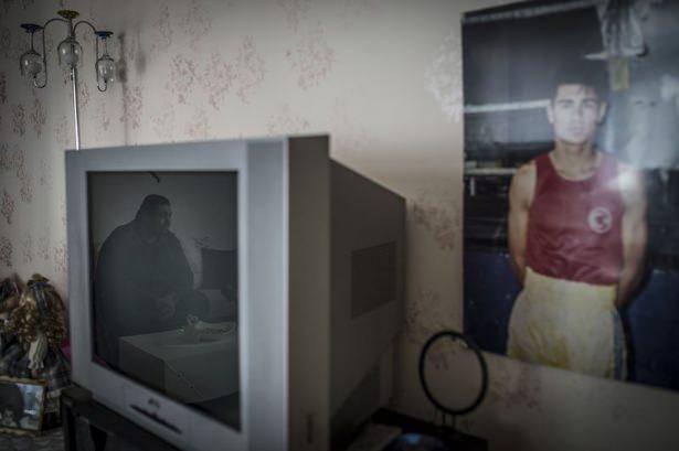 <p>Sam, kilo verememesi nedeniyle kız kardeşinden karaciğer naklinin gerçekleşemediğini anlattı. Bakanlıktan nakil için sıra beklediğini ifade eden Sam, "Olumlu sonuç çıkarsa nakil yapılacak. Canlıdan canlıya nakillerde kiloya önem veriyorlar. Kız kardeşimin kilosu bayağı düşük çıktı, bu nedenle kendisinden nakil olamadı. Rejim yaptım, kilo verdim ama son 4 kiloyu veremedim" dedi.</p>