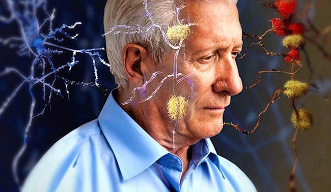 <p>Alzheimer'ı önlemek ya da ilerlemesini yavaşlatmak için; </p>

<p> </p>
