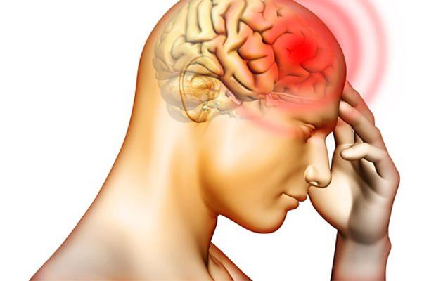 <p><strong>Tip 4: </strong>Çok nadir görülen şekli olup tüm beyincik dokularının gelişmemesi sonrası beyin ve beyincik dokuları sarkmasıdır. </p>
