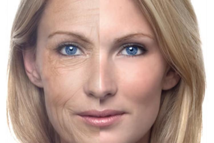 <p>4. <strong>Anti-aging</strong> etkiye sahiptir. Bu yüzden de <strong>yaşlanma süresini</strong> uzatır.</p>
