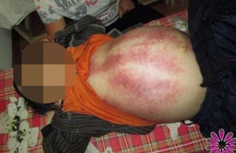 <p>Sözde ‘şifacı’ pek çok şehirde ‘tokat seminerleri’ veriyor ve modern tıbbın insanları zehirlediğini iddia ediyor.</p>