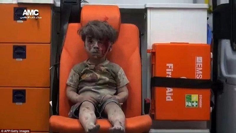 <p>Rusya’nın 17 Ağustos’ta Halep’te düzenlediği hava saldırısında başından yaralanan 4 yaşındaki Ümran adlı erkek çocuğunun ambulansta çekilen fotoğrafı, AFP’nin seçtiği en çarpıcı karelerden biri.</p>
