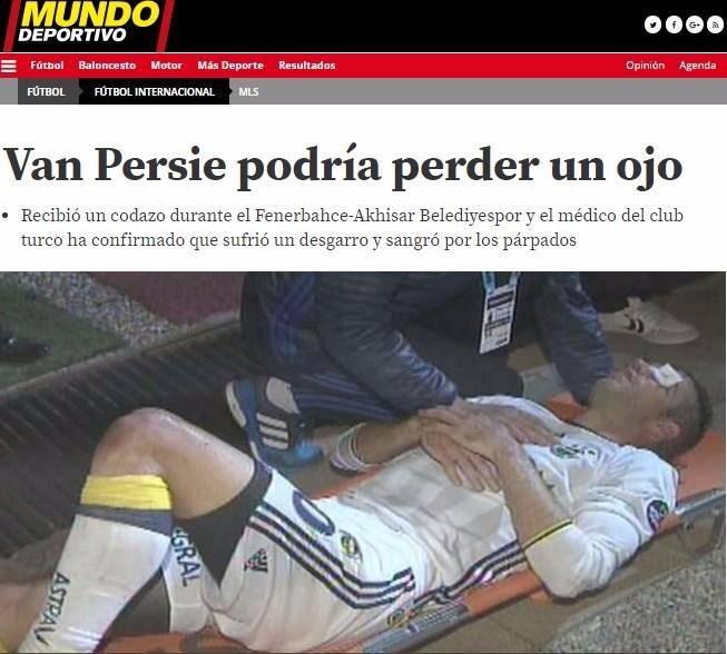 <p>Mundo Deportivo: "Van Persie bir gözünü kaybedebilirdi"</p>

