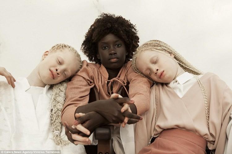 <p>Doğal güzellikleri ile dikkat çeken albino ikizler, İsveç fotoğrafçı Vinicius Terranova tarafından görüntülendi.</p>
