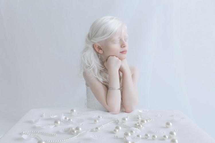 <p>Projedeki o kadar insan içerisinde en çok Albinism'liler dikkat çekti..</p>