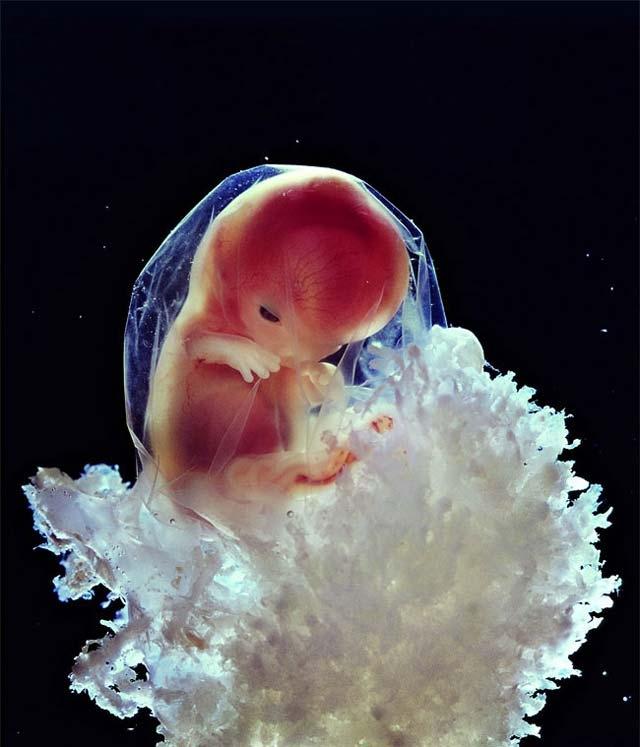 <p>Nilsson, tüm bu önyargıları kırmaya <strong>embriyo ve fetüs </strong>fotoğrafları ile başladı.</p>
