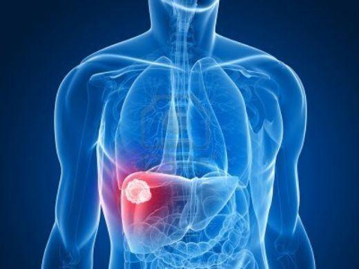 <p>Uzun süre ilaç kullanımı, aşırı alkol tüketiminden ya da metabolik problemlerle ortaya çıkan karaciğer yağlanması düzenli beslenme ile nasıl önlenebilir? </p>