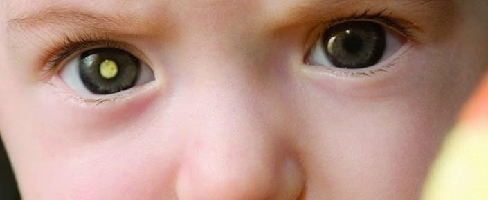 <p>Küçük yaştaki çocuklarda göz problemleri 7-8 yaşına kadar kendini belli etmez. Bu yaşlardaki çocukların göz muayeneleri ihmal edilmemelidir.</p>
