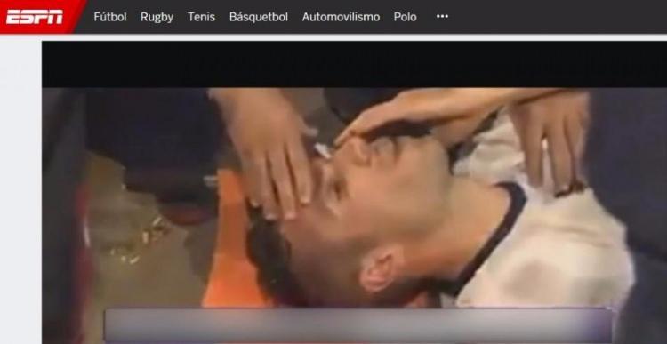 <p>ESPN: "Gözünden tehlike atlatan Van Persie'nin durumu iyi"</p>
