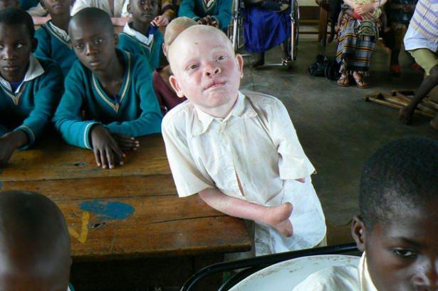 <p>Özellikle Tanzanya’nın iç kesimlerinde insanların en yakın su kuyusuna gitmek için kilometrelerce yürüdüğü yerleşim yerlerinde albino çocuklar kolay av.</p>

<p> </p>
