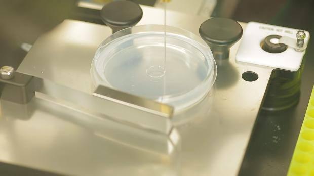 <p><span>“Aort damarı vücuttaki en büyük ve tek damar olduğu için vücudun başka yerinden alınacak damarla tedavisi mümkün değil.</span></p>