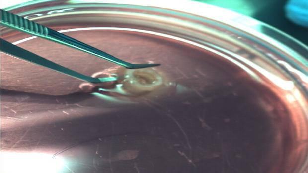 <p>Şu anda tedavisinde sentetik damarlar kullanılıyor. Ama bunlar hiçbir zaman insanın kendi damarları gibi olmuyor. İkinci sebepse, 3 boyutlu yazıcıyla doku ve organ üreteceksek bu doku ve organların beslenmesi için öncelikle damar dokusunun oluşturulması gerekiyor. Bizim çalışmamız sonucunda, abdominal (karın) aort damarı hastanın kendi hücre veya kök hücrelerini kullanarak üretebilecek ve yapay damar bu tür hastalara nakledilebilecek. Şu anda yolun başındayız, hastalara uygulanması yıllar alabilir. Ancak ilaç sanayi için önemli bir aşama. İlaç denemelerini bu şekilde üretilen dokularda yapabilirler.”</p>