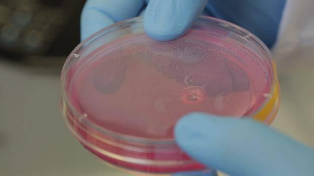 <p>Bilim adamı Einstein’ın ölüm sebebinin abdominal(karın) aort anevrizması olduğunu anlatan Koç, “Bizim çalışmamız sonucunda, abdominal aort damarı hastanın kendi hücre veya kök hücrelerini kullanarak üretilebilecek ve yapay damar bu tür hastalara nakil edilecek” dedi.</p>