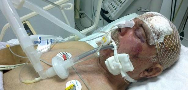 Levent'teki 'Plazalar bölgesi'nde geçtiğimiz salı günü yaşanan akıl almaz kazada başına kalıp tahtası düşen Dursun Yılmaz, tedavi gördüğü hastanede bu sabah yaşamını yitirdi.