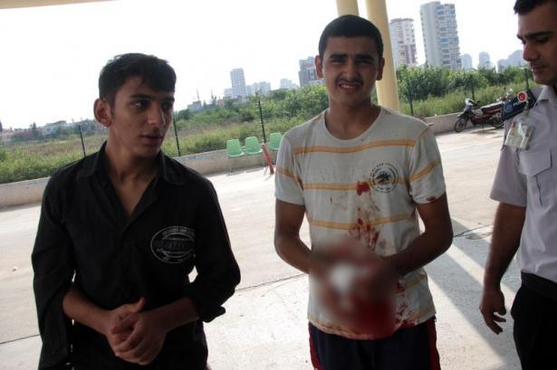 <p>Erzurum'da Bayram Namazı'nın hemen ertesinde kurban kesmeye çalışırken yaralanan 55 kişi hastanelere başvurdu</p>
<p> </p>
