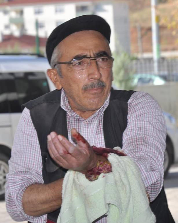 <p>Vücutlarının çeşitli yerlerinde yaralanma oluşan vatandaşların bir kısmı, tedavilerinin ardından taburcu edildi. Sağlık durumu ciddiyetini koruyanların tedavisinin ise sürdüğü belirtildi.</p>
<p> </p>