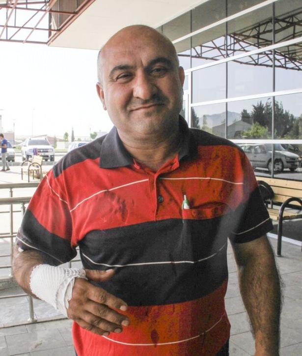 <p>Kimisinin elinden kimisinin de ayağından yaralandığı görülen yaklaşık 60 kişi, kentteki hastanelerin acil servislerine başvurdu.<br />
Yaralılardan İbrahim Tektek, para kazanmak amacıyla kurbanlık keserken yaralandığını söyledi.<br />
Kurbanlığı kestikten sonra derisini yüzmeye başladığını anlatan Tektek, bu sırada kullandığı bıçağın kayarak elini kestiğini anlattı.</p>

