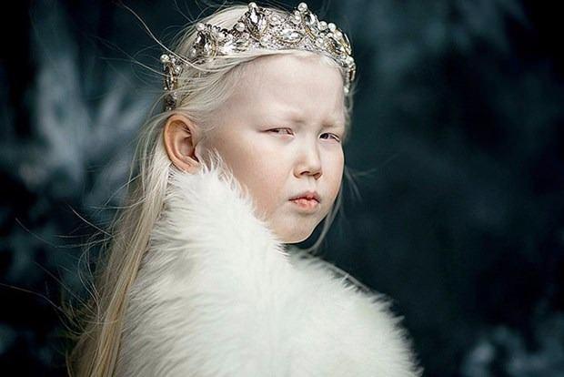 <p>Bunun üzerine modellik ajansları<strong> 8 yaşındaki albino hastası </strong>Nariya'nın peşine düştü.</p>
