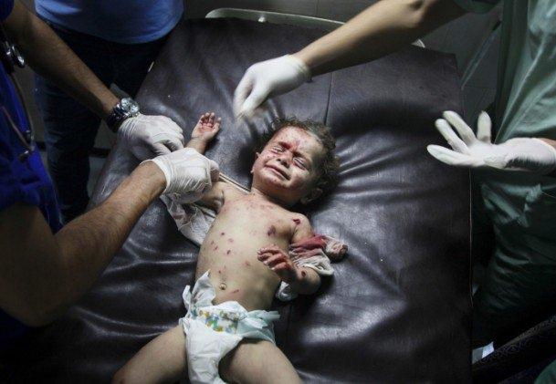 <p>Anadolu Ajansı Gözüyle 2014: İsrail'in Gazze Şeridi'ne kara harekatı ile devam ettirdiği saldırılarda çoğunluğu çocuklardan oluşan yaralılar, tedavi edilmek üzere Gazze'deki Şifa Hastanesi'ne getirildi. 18.7.2014 (Ezz Al-Zanoun - Anadolu Ajansı)</p>
<p> </p>