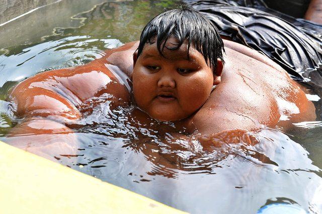 <p>Dünyanın en şişman çocuğu olan Arya Premana, tüp mide ameliyatı sonrası 31 kilo verdi.</p>
