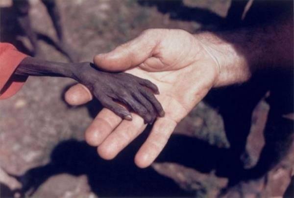 <p>1980 Yılında, Ugandalı Bir Çocuk İle Yardım Görevlisi, 1980</p>
<ul>
</ul>