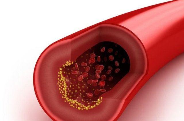 <p>12. Toplam kolesterol değerim 5.2 mmol/litrenin altında.</p>

<p> </p>
