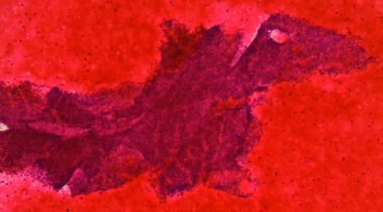 <p>Sanat eseri gibi görünen bu fotoğraflar Prof. Dr. Fahri Yılmaz’ın arşivinden. Yılmaz’ın 11 yıllık çalışmasında topladığı 107 adet fotoğrafın ne olduğunu öğrenince çok şaşıracaksınız.</p>