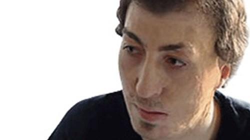 Türkiye'de ikinci yüz nakli olarak tarihe adı geçen Cengiz Gül, operasyonun ardından tam yetmiş beş gün sonrasında hastaneden yeni yüzüyle taburcu oldu.