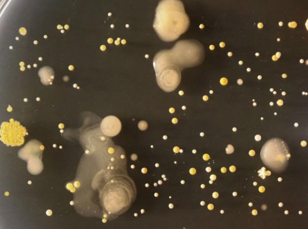   İngiltere'deki Surrey Üniversitesi Mikrobiyoloji bölümü öğrencileri cep telefonlarına yakından bakmaya karar verince bakterileri farkettiler. İnanması zor ama cep telefonlarında tuvaletin 18 katı daha fazla bakteri bulundu. 