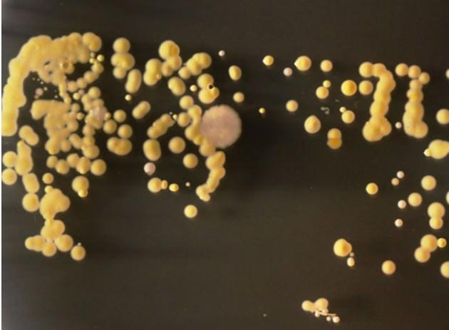   Öğrenciler, bakterileri laboratuvarlarda ürettiler ve geliştirdiler. Cep telefonunu bakteri üretme kaplarına koyan öğrenciler, 3 gün sonra bu garip yaratıkları görüntülediler. 