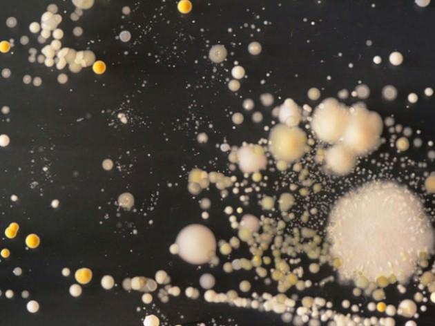   Üniversitede süren çalışmalar sırasında bakteriler fotograflandı ve bu görüntüler büyütüldü. 