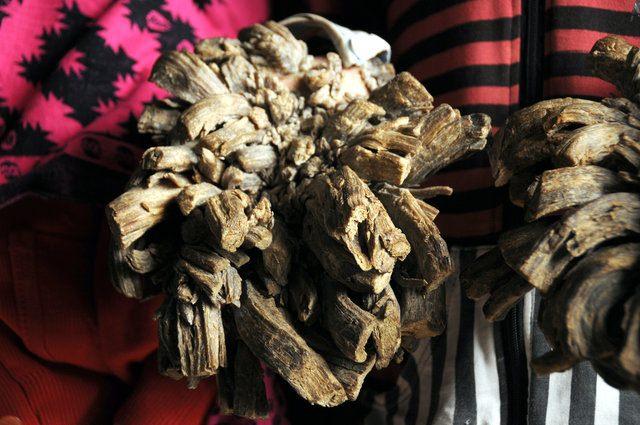 <p>Çok nadir görülen bir hastalık olan ‘Epidermodysplasia Verruciformis’ ile 16 yaşından beri savaşan Bajander'ın tırnaklarındaki keratin maddesinin artması, vücudunun pek çok yerinde yayılan tümörlere ve siğillere neden oldu. </p>
<p> </p>
