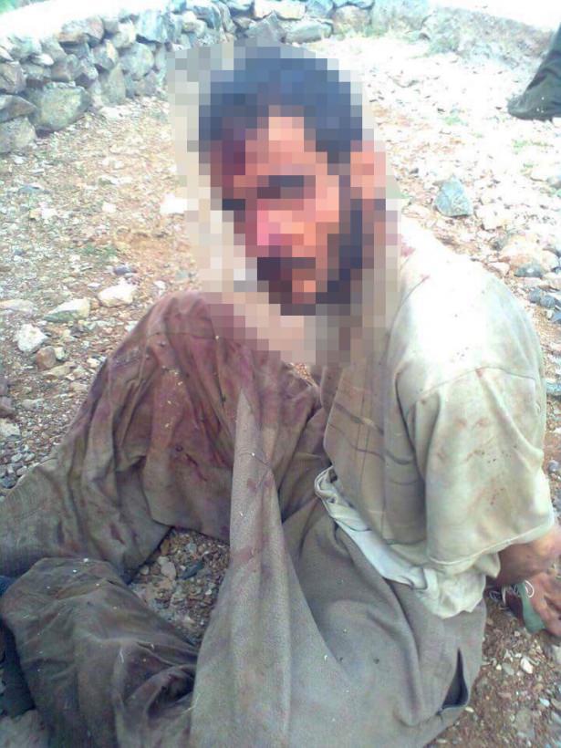 <p><strong>16 şehit verdiğimiz Dağlıca'da başlatılan operasyonda öldürülen ve yaralı ele geçirilen bazı PKK'lılar görüntüleri ortaya çıktı.</strong></p>
