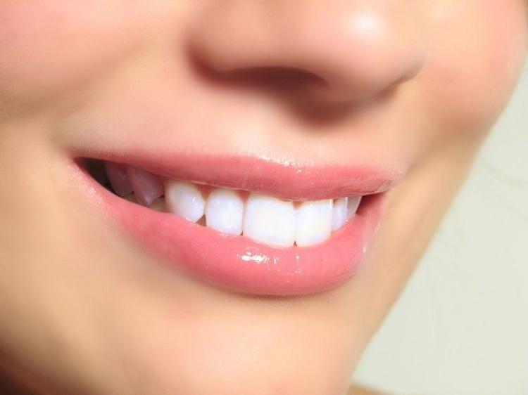 <p>Diş beyazlatma işlemi hakkında yazılı açıklama yapan Eşkar, dişlerin yapısındaki renklenmelerin veya koyu renkli dişlerin daha estetik bir görüntü vermek amacıyla beyazlatılması işleminin "Bleaching" olarak adlandırıldığı bilgisini paylaştı. Eşkar, söz konusu işlemin, daimi dişlerin ağız içinde konumlanmasıyla birlikte her yaştan hastaya uygulanabilir bir yöntem olduğuna işaret ederek, diş beyazlatmanın aşınma-kırık-çatlak ve çürük olan dişlerin mutlaka tedavi edildikten sonra yapılması gerektiğine dikkati çekti.</p>

<p> </p>
