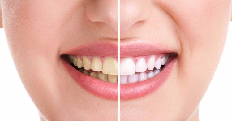 <p>Bu sağlam yapının korunması ve sağlıklı dişlere sahip olmak, sindirim sisteminin doğal işleyici için çok önemlidir.</p>

