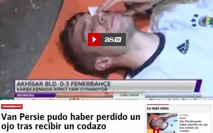 <p>As: "Dirsek atılan Van Persie gözünü kaybedebilirdi"</p>
