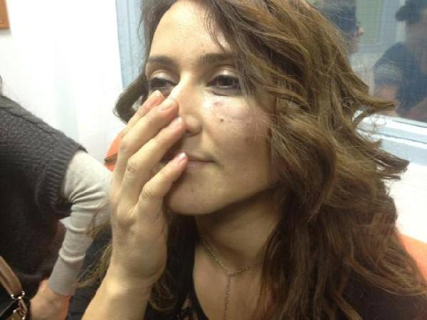 Fransa'daki Ermeniler'in, Fransız Ulusal Meclisi'nde Sumget olayları ve Dağlık Karabağ sorunu ile ilgili yaptıkları toplantıda soru soran ve "Bugün Hocalı katliamının yıldönümü" diyen iki Azeri'yi dövdüğü belirtildi.