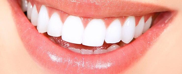 <p>Ev tipi beyazlatmada ise, kişiye özel hazırlanan alt üst ve çene dişleri için plakalar hazırlanır. Bu plakalar ve diş beyazlatma ajanları ile evde kolayca uygulama yapılır.</p>
