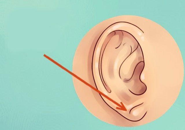 <p>Eğer çapraz kulak kırışıklığınız varsa, muhtemelen koroner arter hastalığı geçirmiş olabilirsiniz.</p>

<p> </p>
