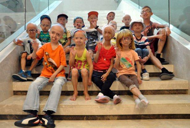 <p>Erken yaşlanma olarak bilinen progeria hastalığına dikkat çekmek için Türkiye'de ilk kez '2014 Progeria Çocukları Buluşması' gerçekleşti.</p>

<p> </p>
