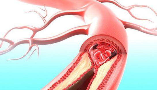 <p>İyi huylu kolestrol damarlarımıza yerleşen kötü huylu kolestrolü, metabolize edilerek vücuttan atılması için karaciğere taşıyarak dolaşımdan uzaklaştırır. </p>
