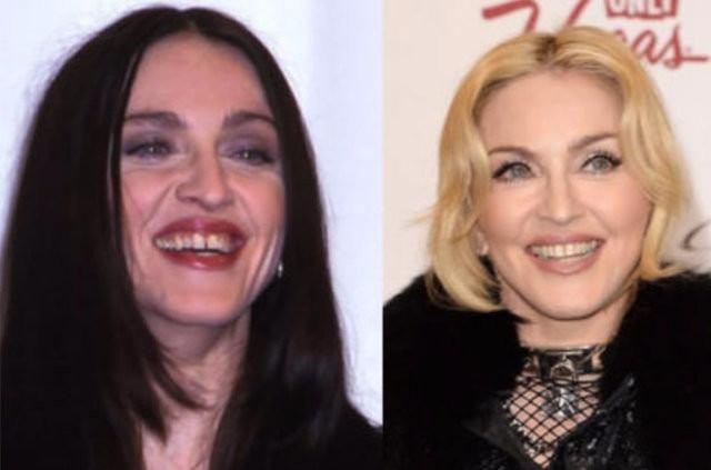 <p>Madonna</p>
