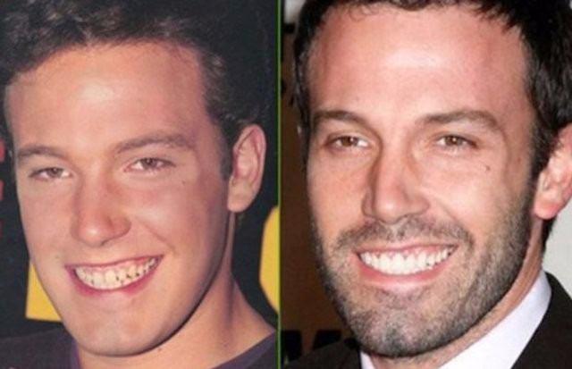<p>Ben Affleck</p>
