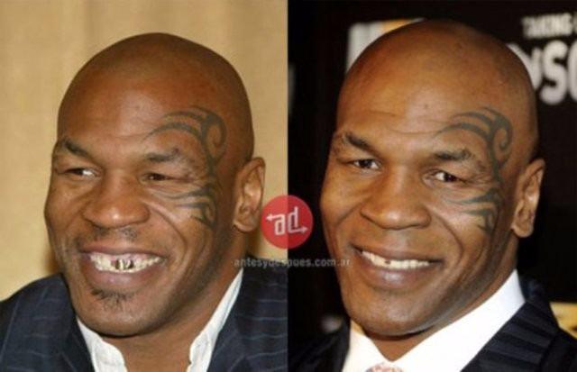 <p>Mike Tyson</p>
