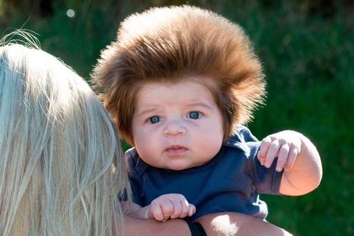 <p>İki aylık iken küçük Cox-Noon'un o kadar çok saçı vardı ki bir gören bir daha bakıyordu!</p>
