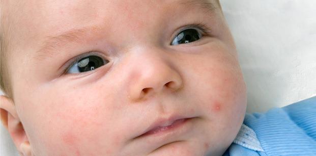 <p><strong>Peki, alerji riski hangi bebeklerde daha az görülür?</strong></p>
