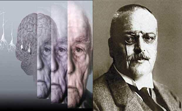 <p>Alzheimer Alman bilim adamı Alois Alzheimer, Frankfurt'taki bir hastanede yatan hastanın semptomlarını incelemeye başlamıştı. Kısa süreli hafıza kayıplarının baş gösterdiği bu hastalığın sunumu 3 kasım 1906'da yapıldı ve Alzheimer olarak anılmaya başlandı.</p>
