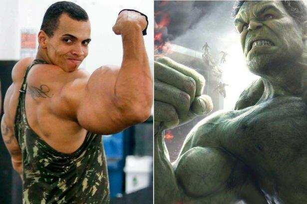 <p>Brezilya'da yaşayan Romario Dos Santos Alves adlı fitness sporcusu, kullandığı ilaç yüzünden kaslarını kaybetmekle karşı karşıya kaldı, son anda kurtuldu</p>